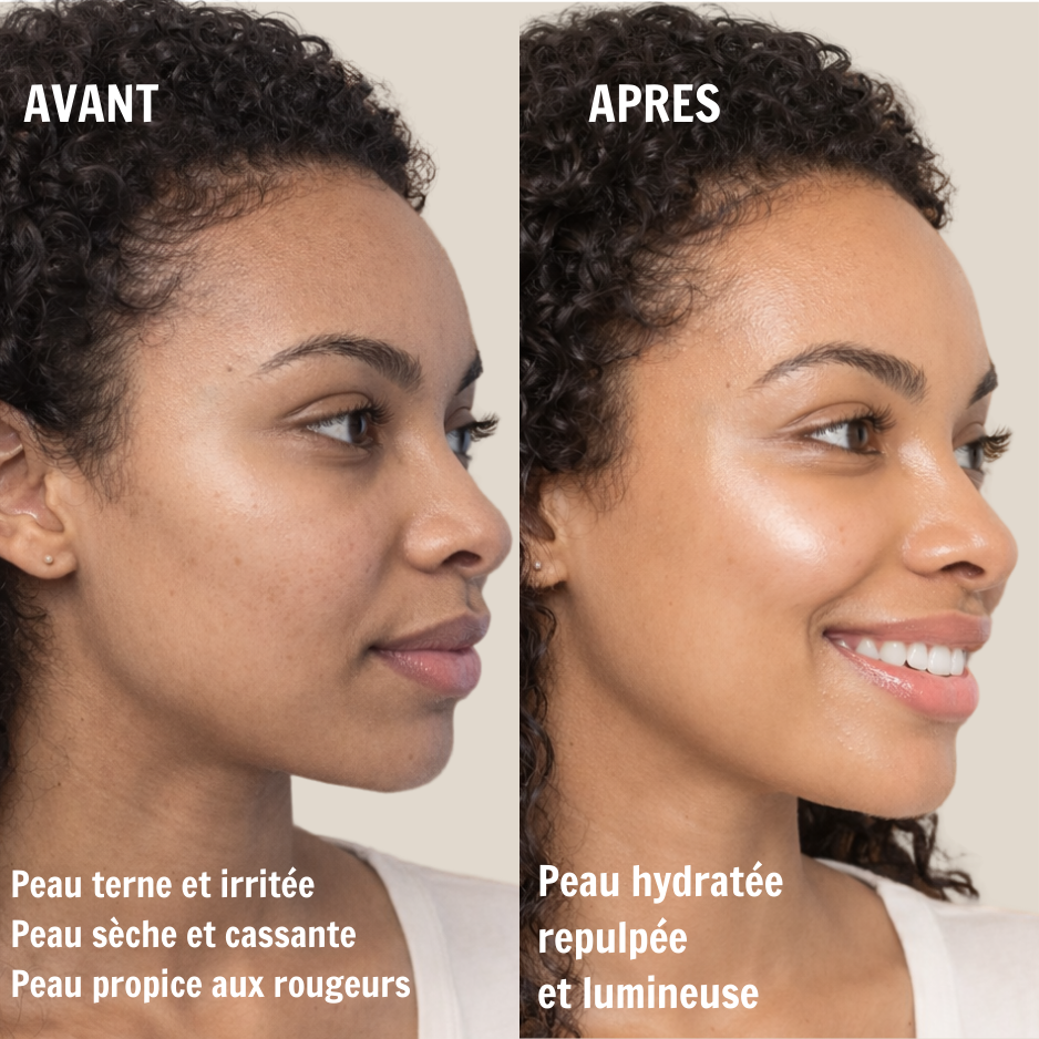 5 Masques Visage Hydrogel